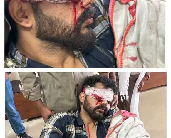 आतिशबाजी के दौरान युवक की आंख बुरी तरह हुआ जख्मी।